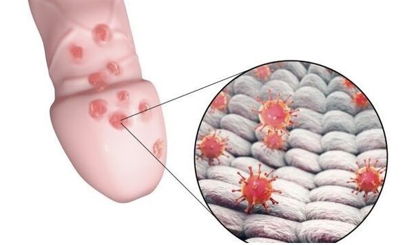 penis büyütme jeline alerji